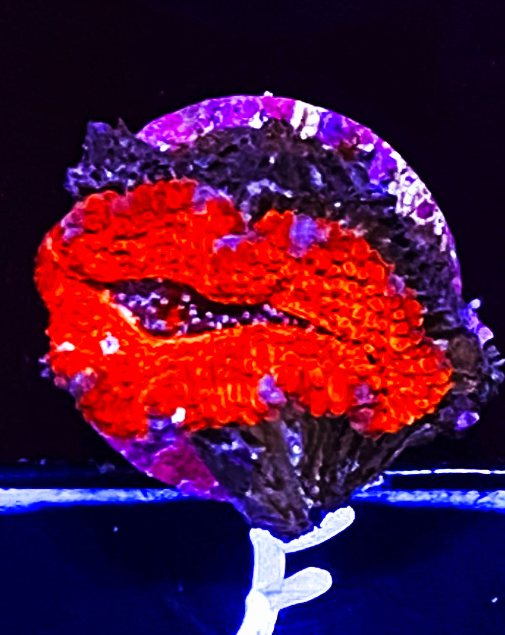 W7-E1 XL Acan